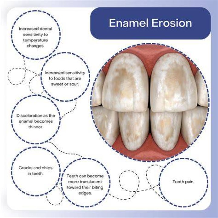 Can baking soda erode tooth enamel?