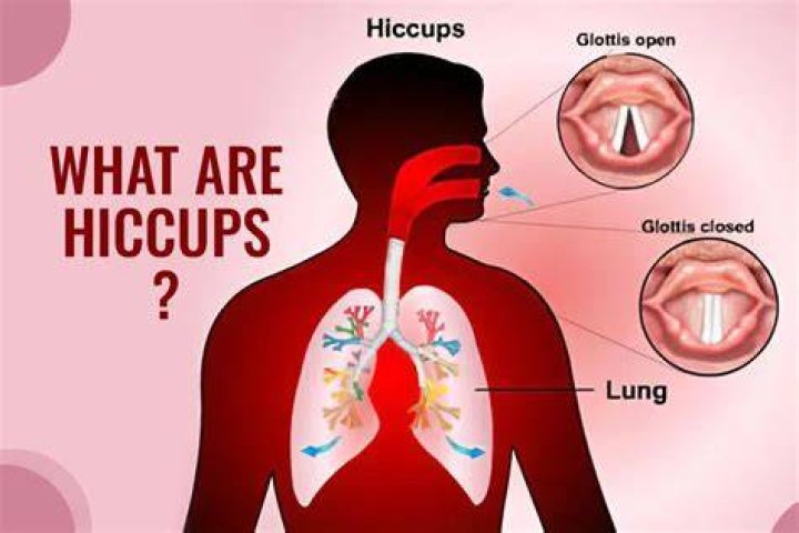 What happens when you hiccup?
