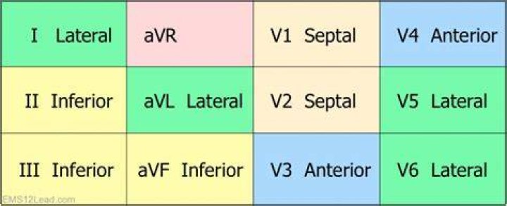 Which ecg leads are contiguous?