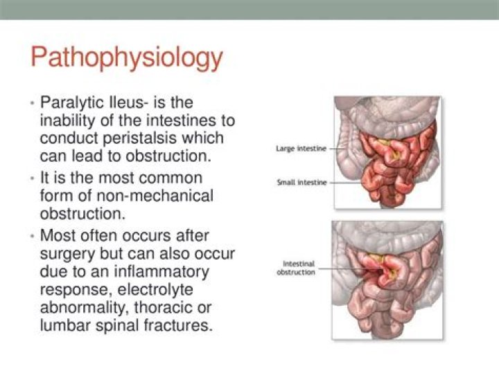 Why does hypokalemia cause paralytic ileus?